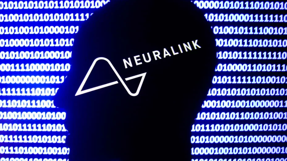 neuralink – Stankevicius